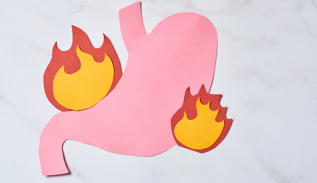 No More Heartburn: The Natural Acid Reflux Approach