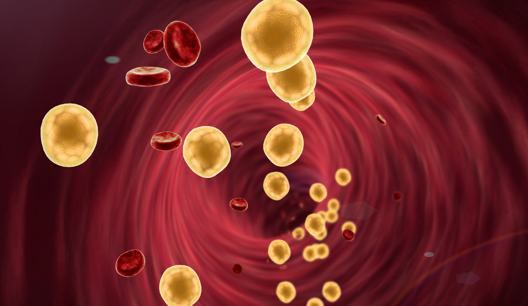 Cholesterol: Balancing The Good And The Bad